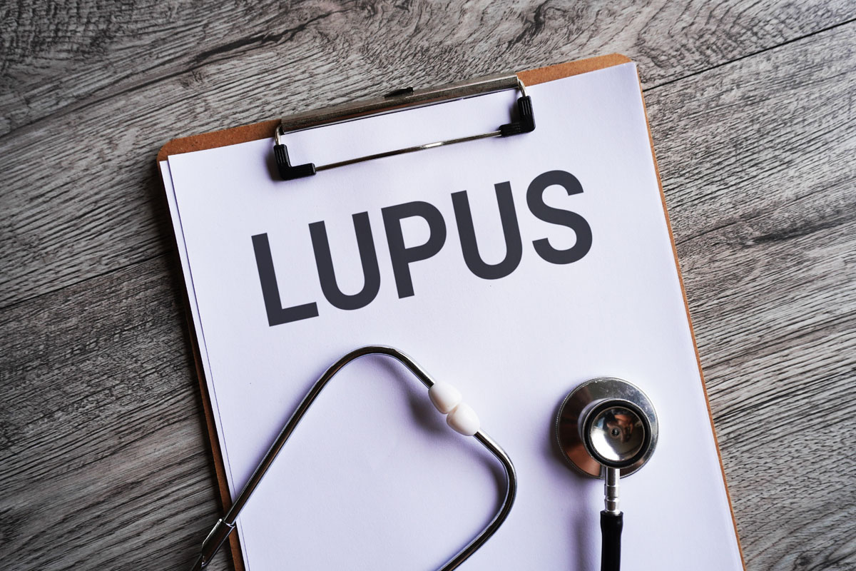 What-is-lupus